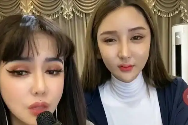 桃花宝宝花上百万整容,前后模样对比太吓人,网友:亲妈都不认识