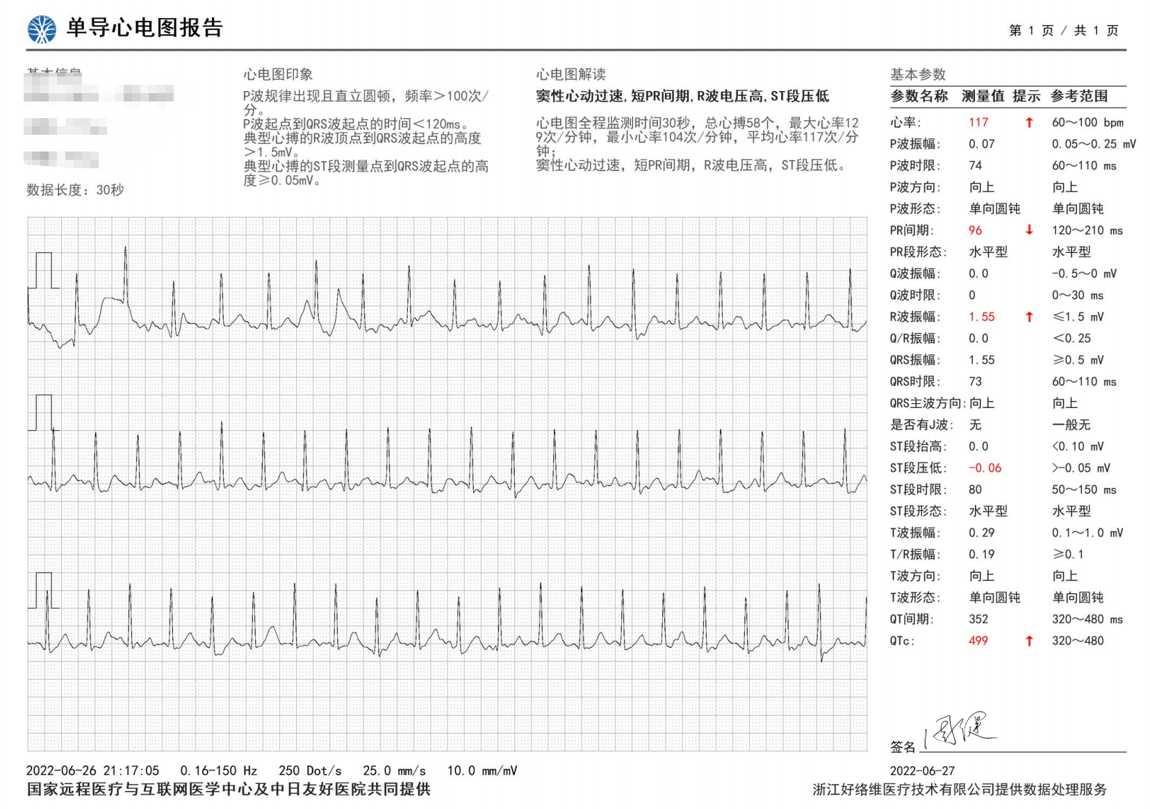 华为GT3Pro我还是比较满意的