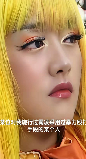 33岁女星自曝被暴力殴打！紧急报警维权，直呼绝不向恶势力低头