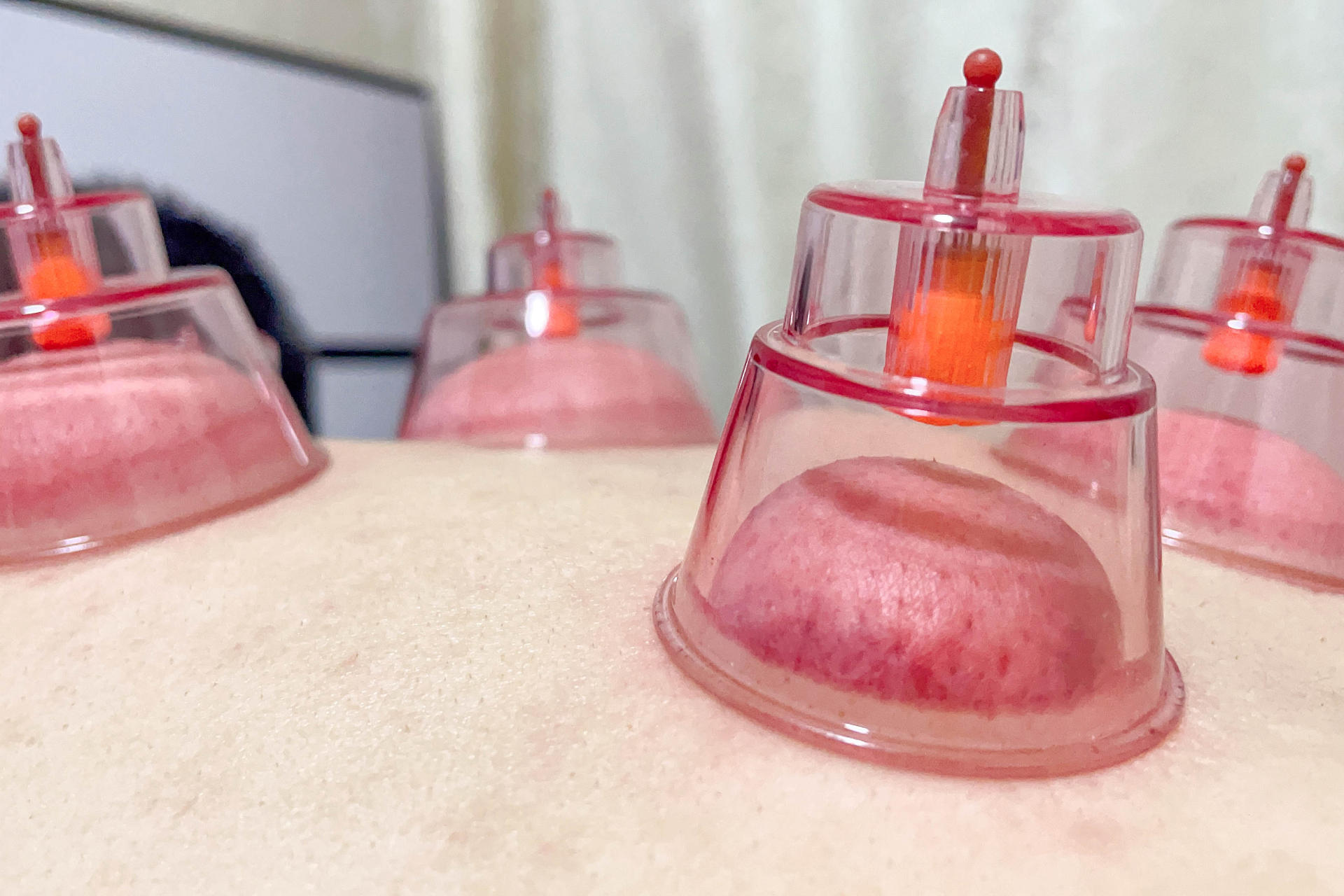 拔罐也要科技化！拔罐+走罐，让设备精准保健