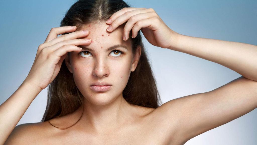 随手挤痘痘会有生命危险？真心劝你手下留情：这4件事都不能做