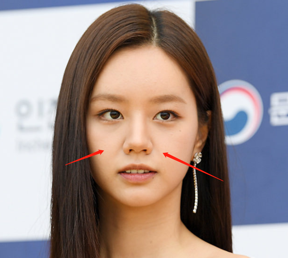 韩国青龙大赏明星生图！没了滤镜颜值集体掉线，金高银发际线堪忧