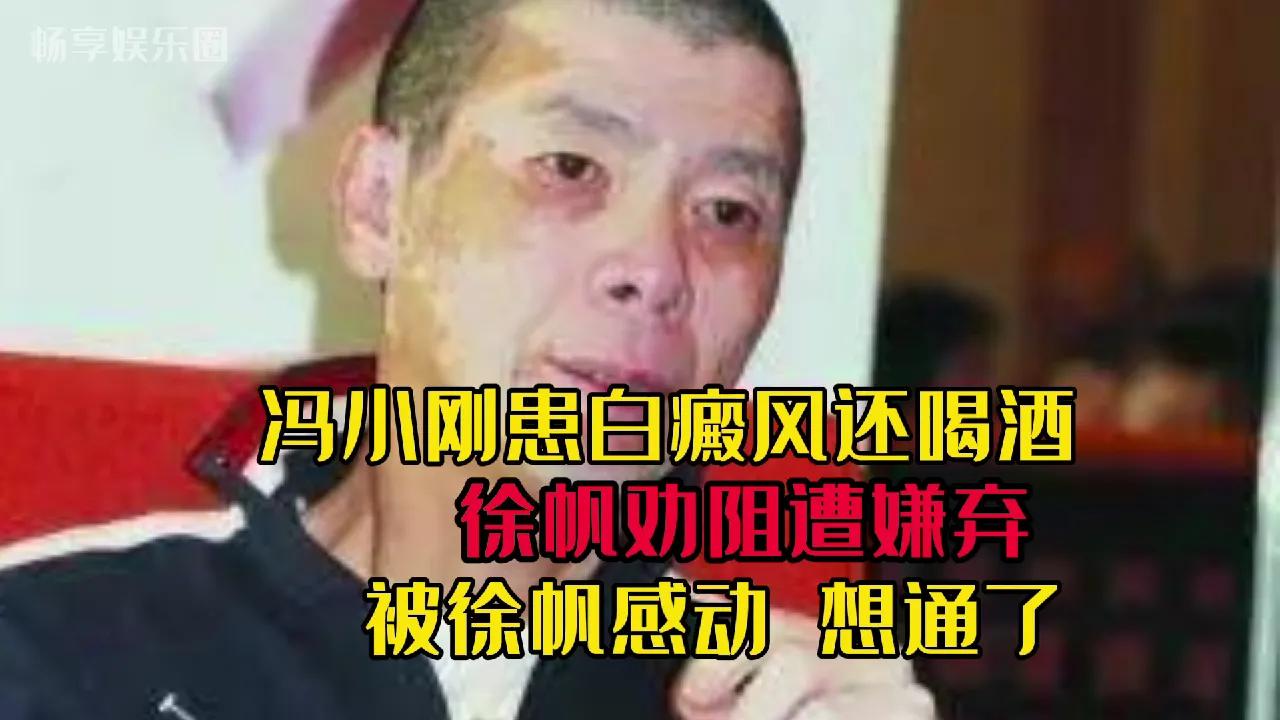冯小刚白癜风波及饮酒习惯引发关注