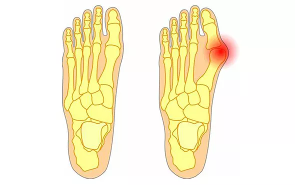 脚的部位名称图和图片(一份"双脚疼痛图解,详解不同位置脚疼原因)