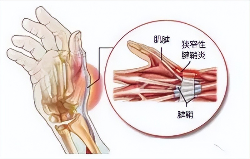 老年人手指僵硬,關節痛,正常嗎?該如何緩解?一文詳細告訴你