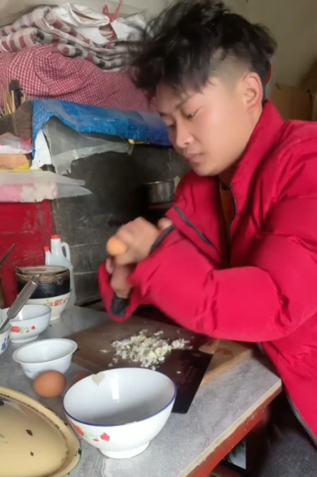 90后农村小伙撞脸张国荣，先天残疾被母亲抛弃，他都经历了什么？