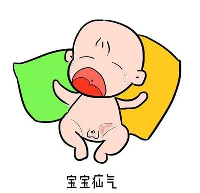 小儿腹股沟疝气即小儿疝气,俗称脱肠,是小儿普通外科中最常见的疾病.