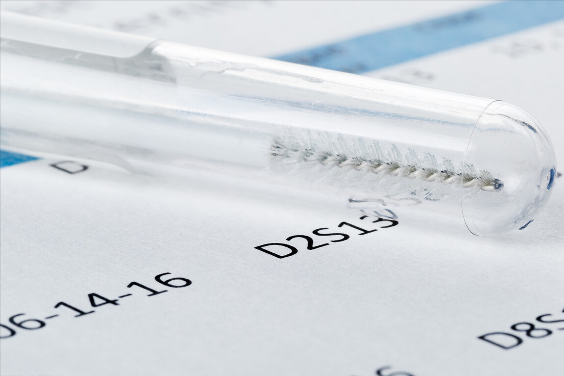 产前亲子鉴定，为何被称为“忠贞杀手”？