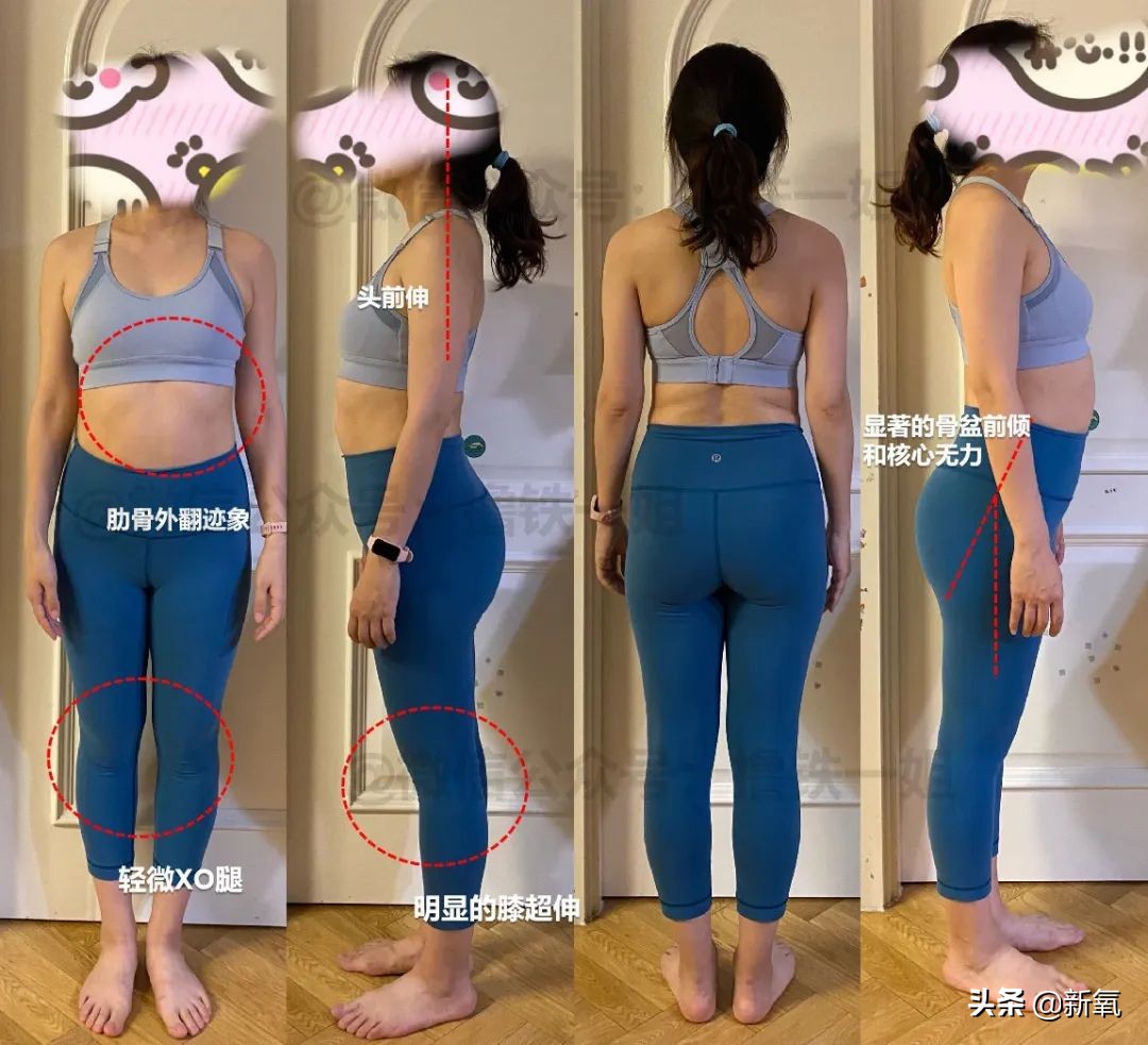 新剧一出场小腹凸成一坨？这翻车的体态硬是被腿精天花板当场救回