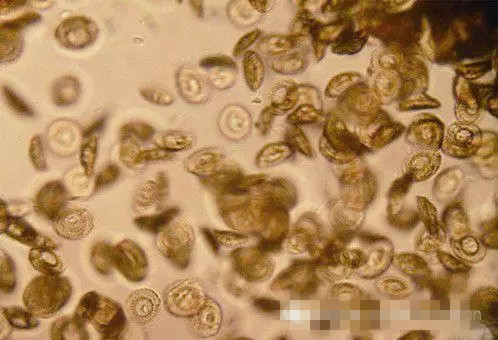 自动标签:养鱼冷冻水产品寄生虫寄生虫病罗非鱼养殖土腥味gsm