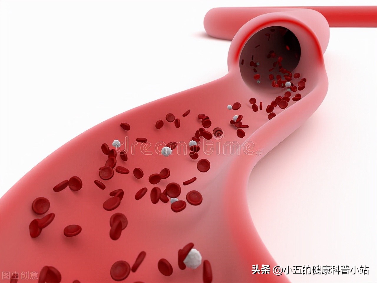 老年人大脑供血不足怎么办？科学使用3类药物，积极改善供血条件