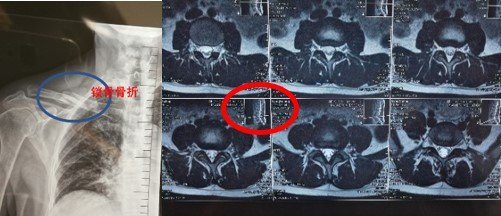 在家也能拍高清X线、CT、磁共振片？医生教你几招，在家轻松看病