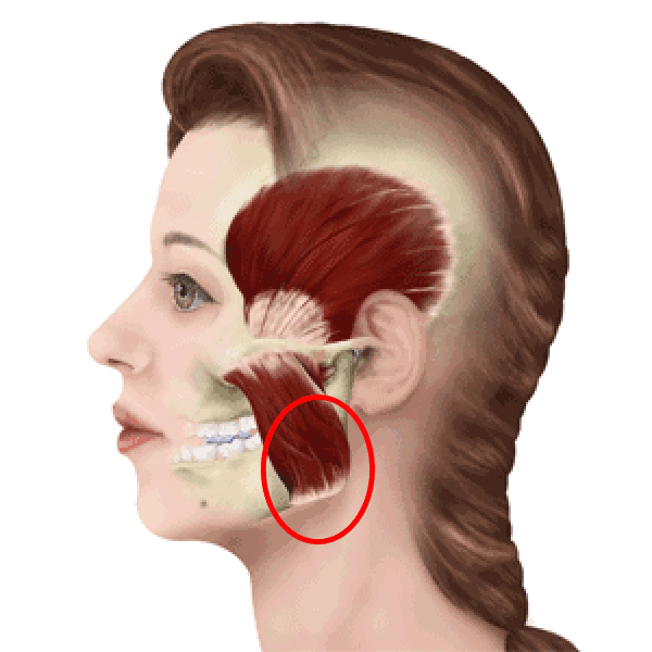 腮帮子里最“有力”的一块肌肉，每个人都该练练