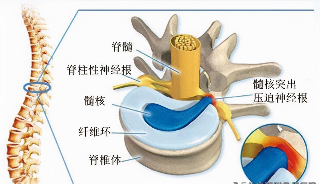 腿摸起来是热的，却总感觉发凉？小心是这种疾病引起的
