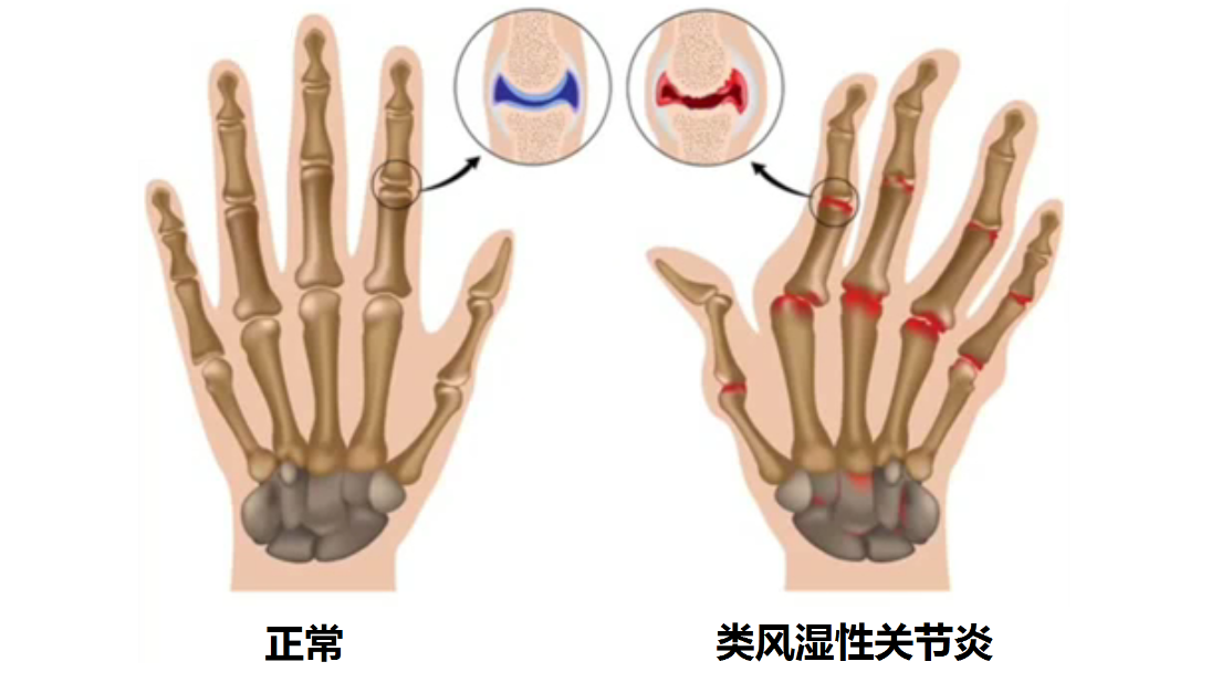 打一針封閉針要多少錢(封閉針到底是) - 價格百科