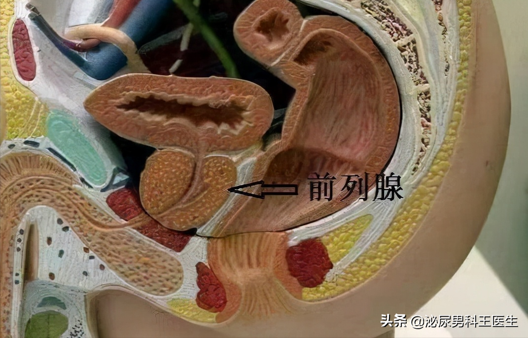 前列腺是"生命腺",怎么判断自己是否得了前列腺炎?