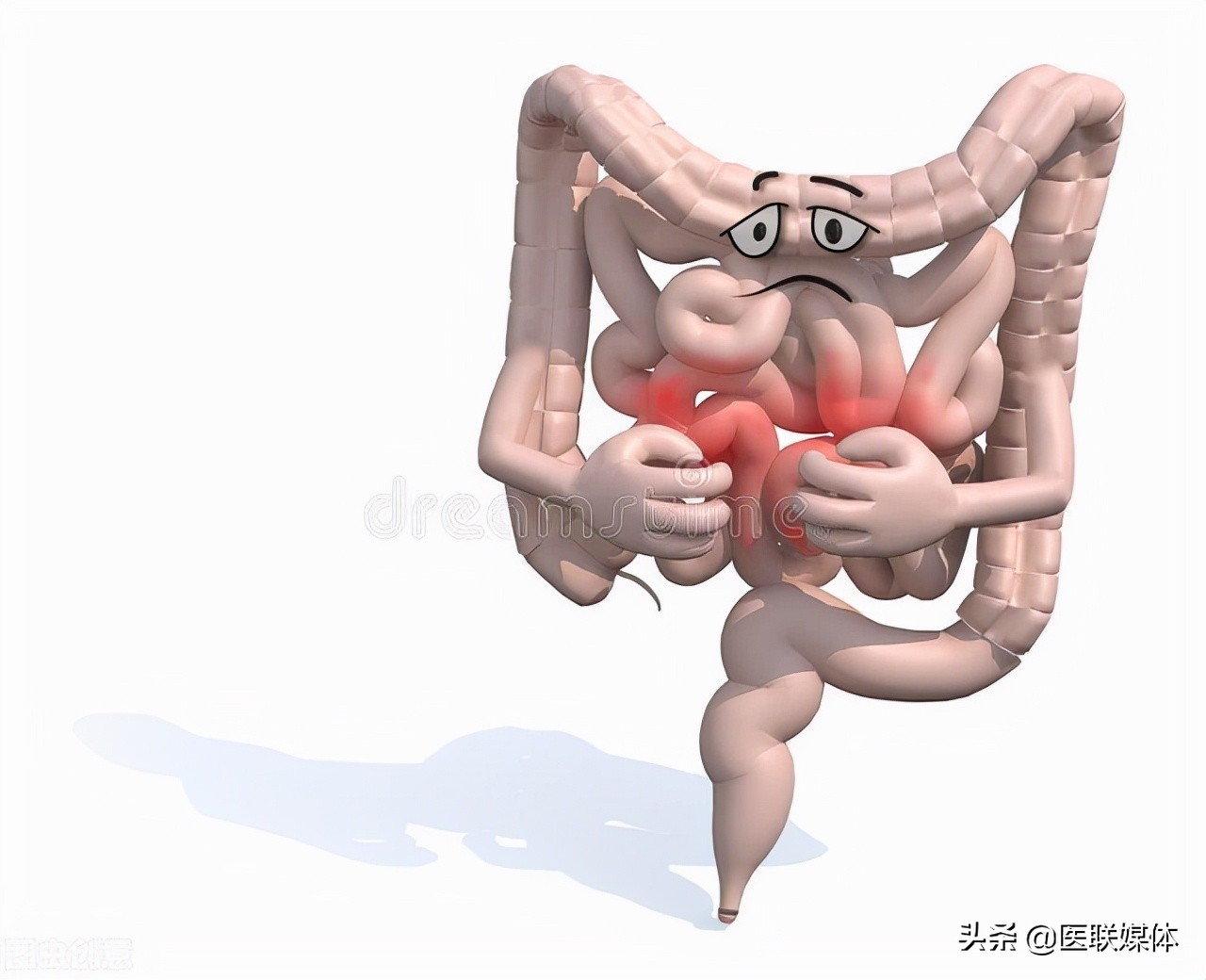 為何腸道容易長息肉？ 或與這3個飲食習慣有關，記得避開