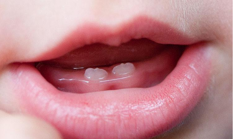 婴儿长牙(宝宝长牙时的症状) - 乐宝宝贝