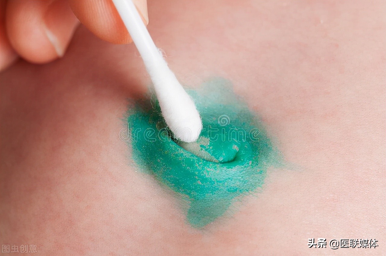 肚脐眼为何不能乱抠？看完这3个后果，赶紧停手