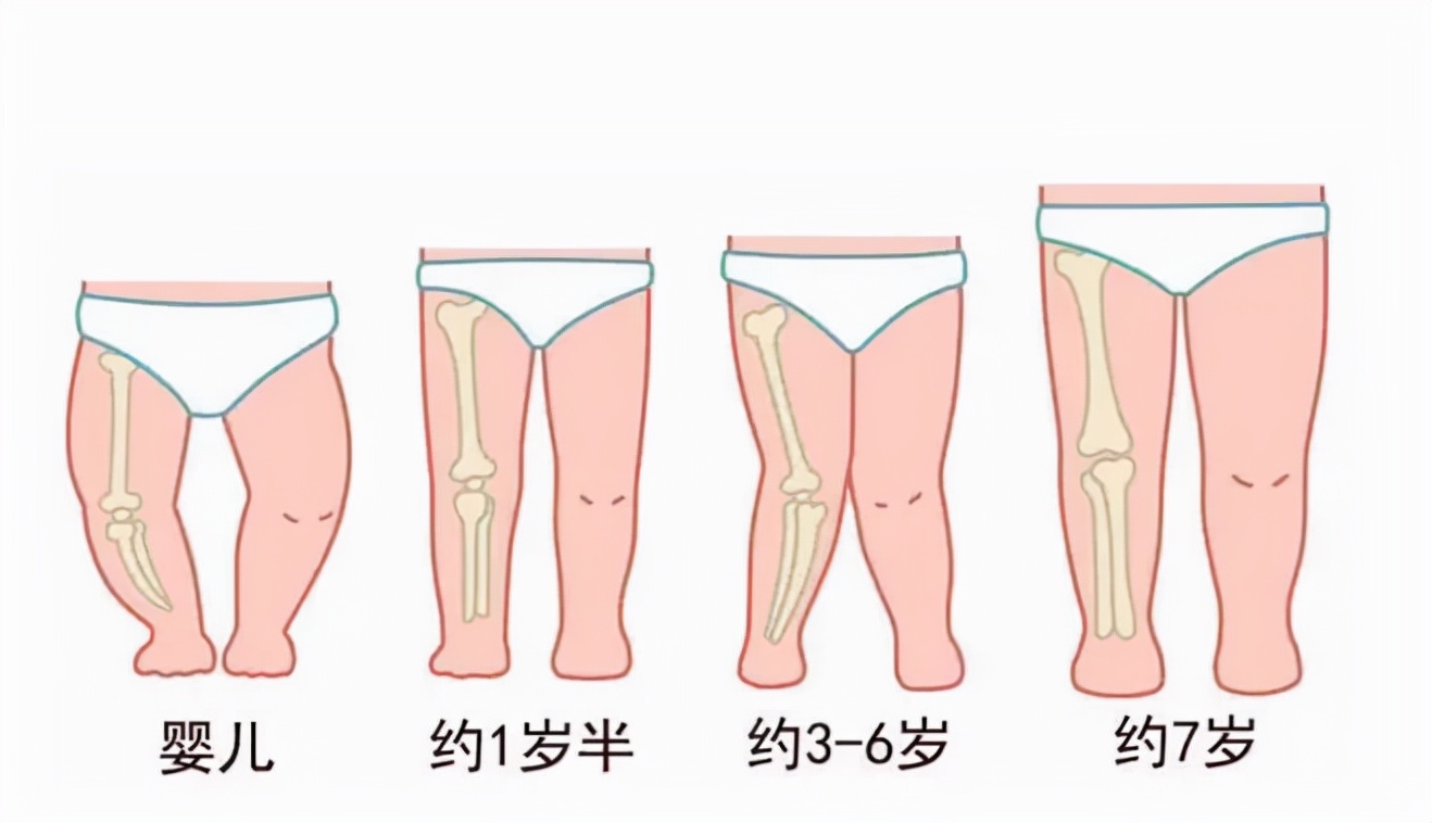 3大误区影响宝宝腿部发育，不尽早改正，小心娃的腿又弯又短