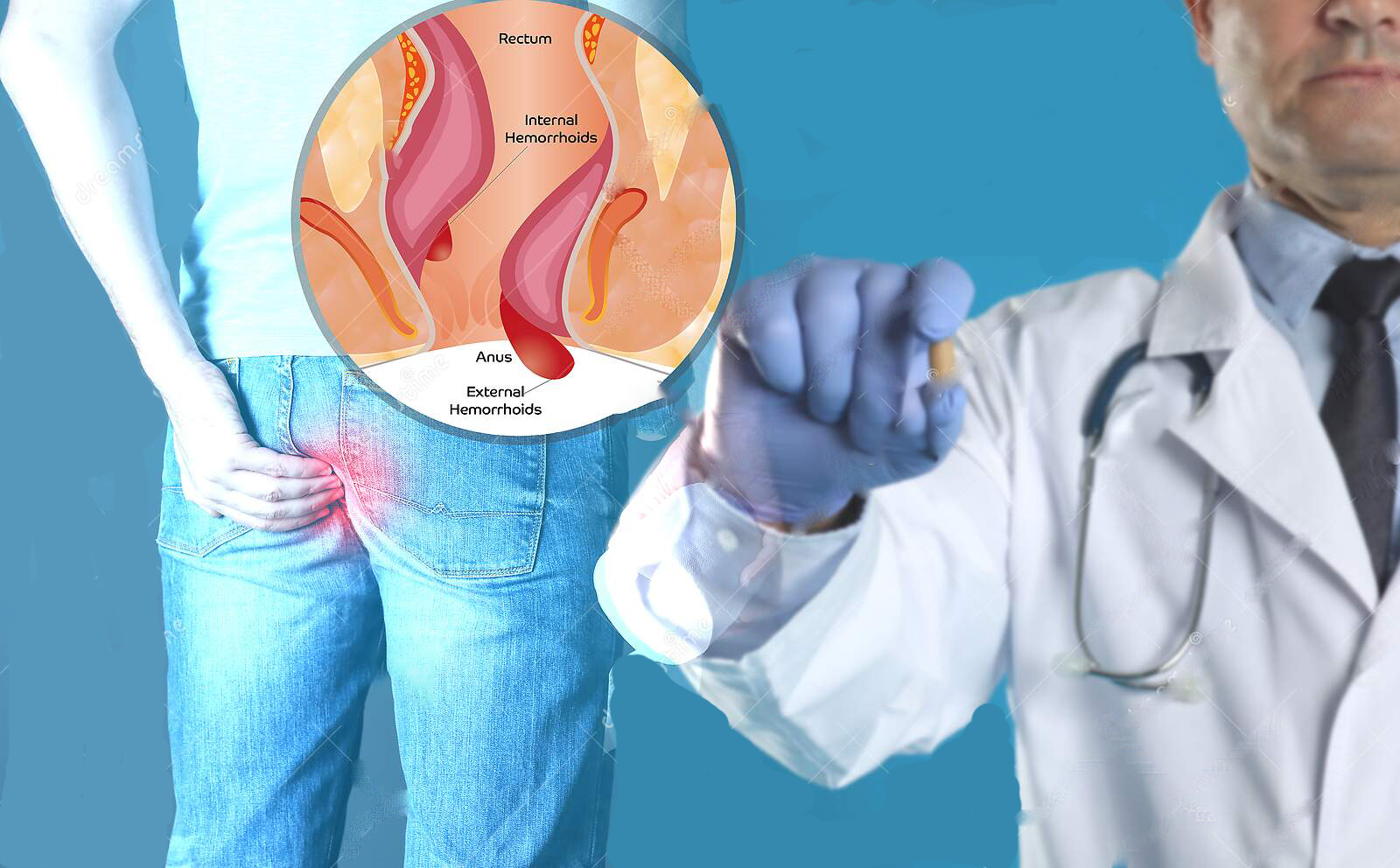 "菊花"残,满地伤,"10男9痔"的痔疮,却是人类进步的标志