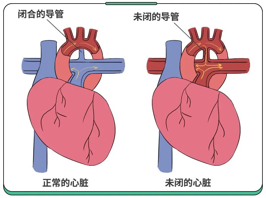 忍痛提醒所有家长：8个症状警惕先心病