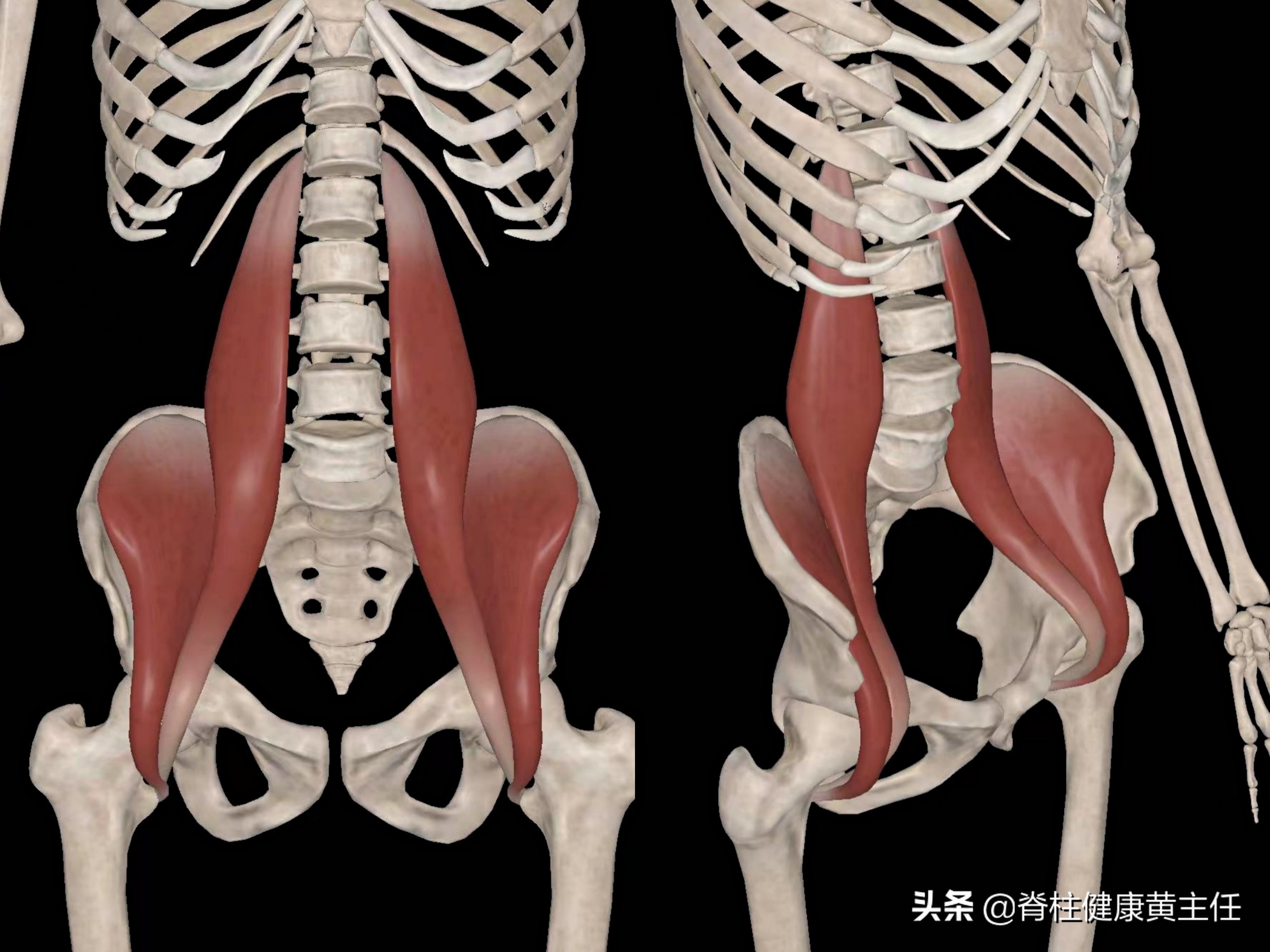 腰痛不是椎间盘突出，也不是腰肌劳损，那会是什么原因？