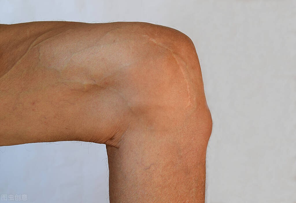 身体出现6个症状，可能是尿毒症的“求救信号”，不要忽视了