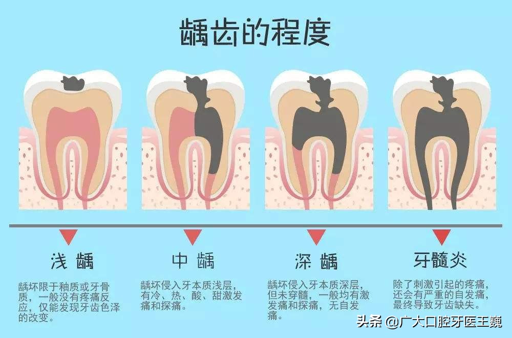 如果你的牙齿上有黑色或者黑点,并且刷牙刷不干净,可能是这两个原因