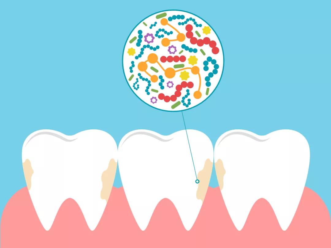 牙齿经常上火、牙龈发炎的人注意了！你们可能已被心血管疾病盯上