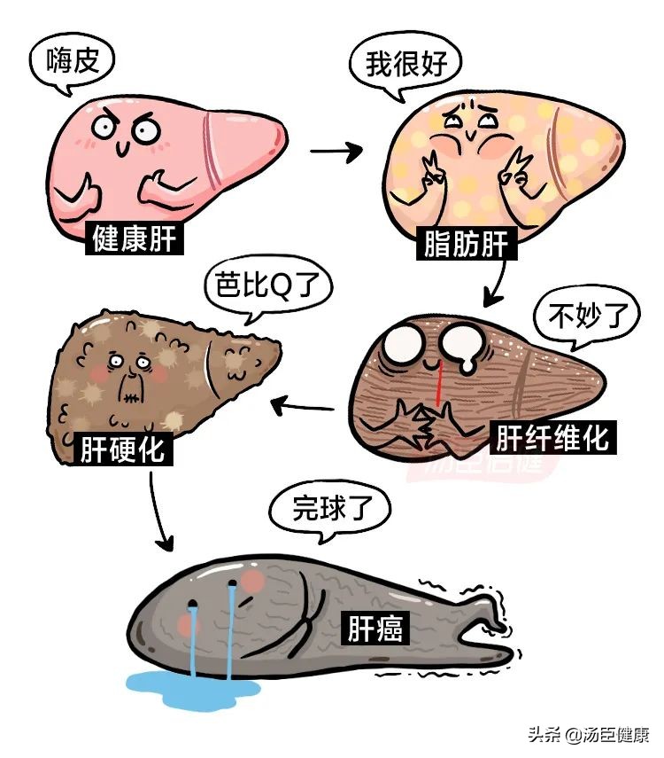 无数人爱喝的这种饮料，是怎样一步步毁掉肝脏的？