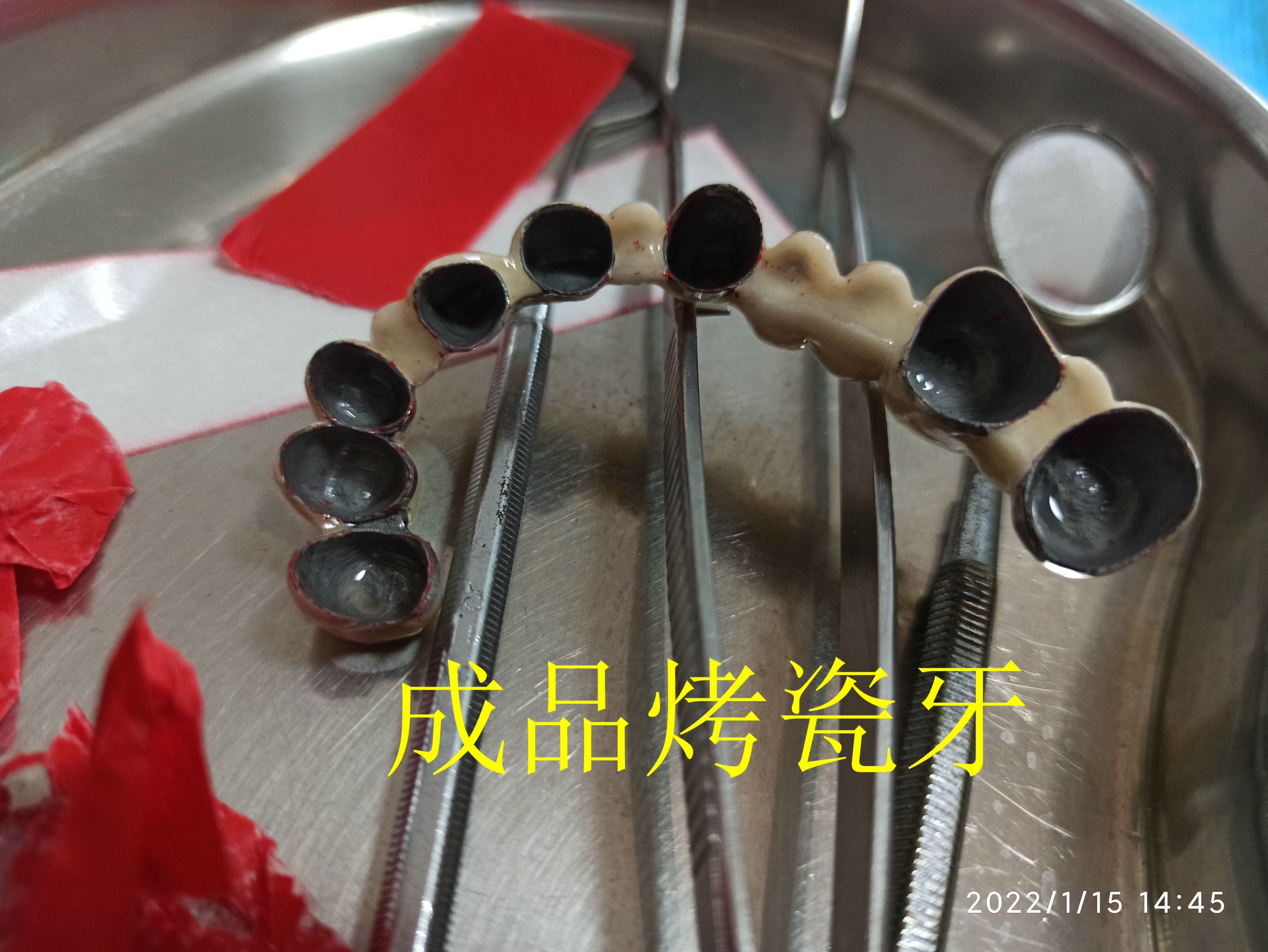 32岁拔了10颗牙，还花8500去镶假牙，我这是遭的哪门子罪呀