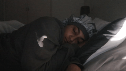 居然有人对水过敏！那该怎么洗澡、喝水、上厕所？
