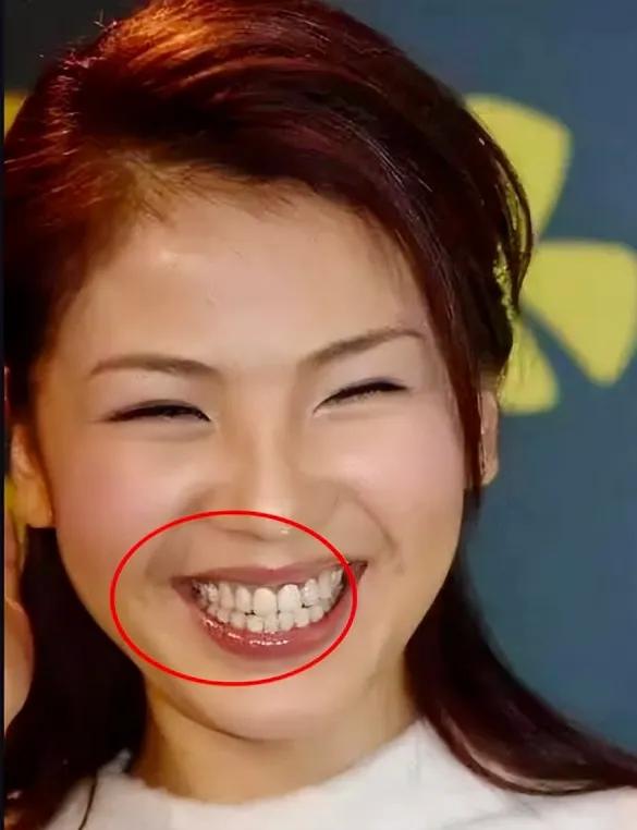 在娱乐圈中有多假，几乎全身任何地方都可以“人造”