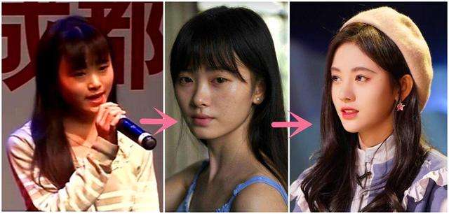 那些整过容的明星(4位整容的女明星:有人意外毁容,有人自毁前途,有人