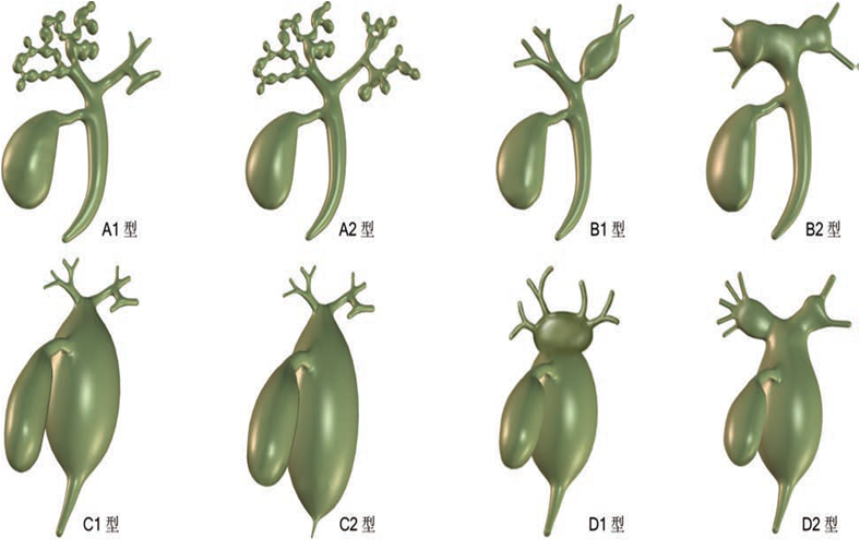 组织结构的6种类型图(是什么病让腹部出现一棵「树」？这个影像学征象必须记住)