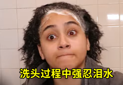 居然有人对水过敏！那该怎么洗澡、喝水、上厕所？