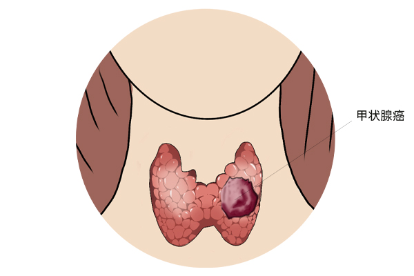 大病来袭前，夜间有异样？睡觉时中出现4种表现，建议早做预防