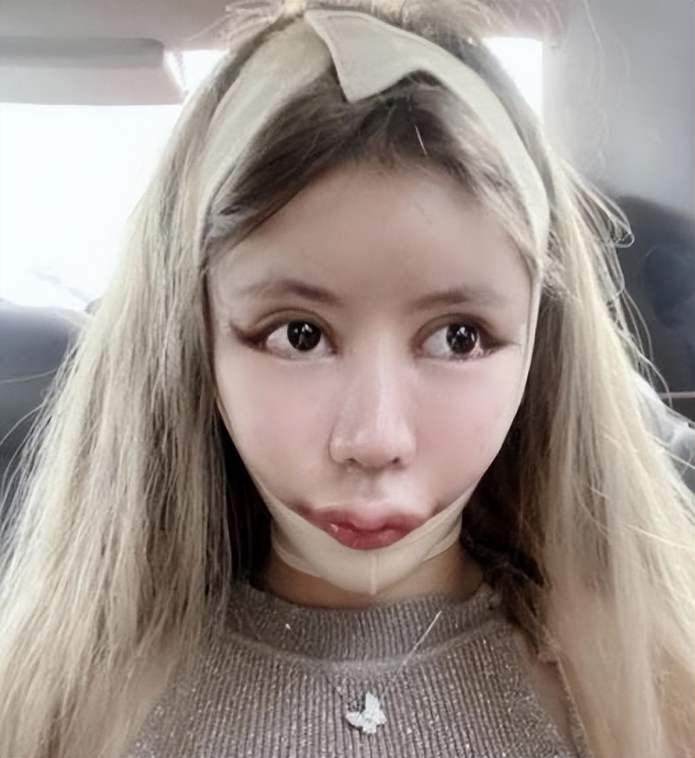 15岁女孩花四百万整形百次,与整容相比,更需要整的是"人心"