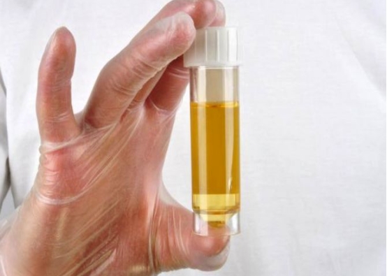 排尿很黄、异味很大？身体或是在向你暗示这5件事，别忽视了