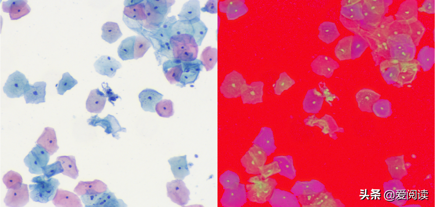 你试过吗？图像（细胞）分割