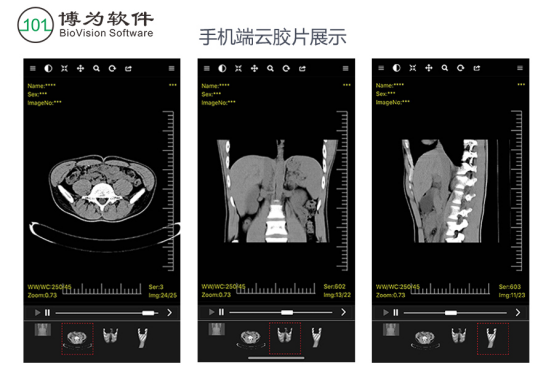 “云影像”时代，博为软件“电子胶片”让百姓就医更方便