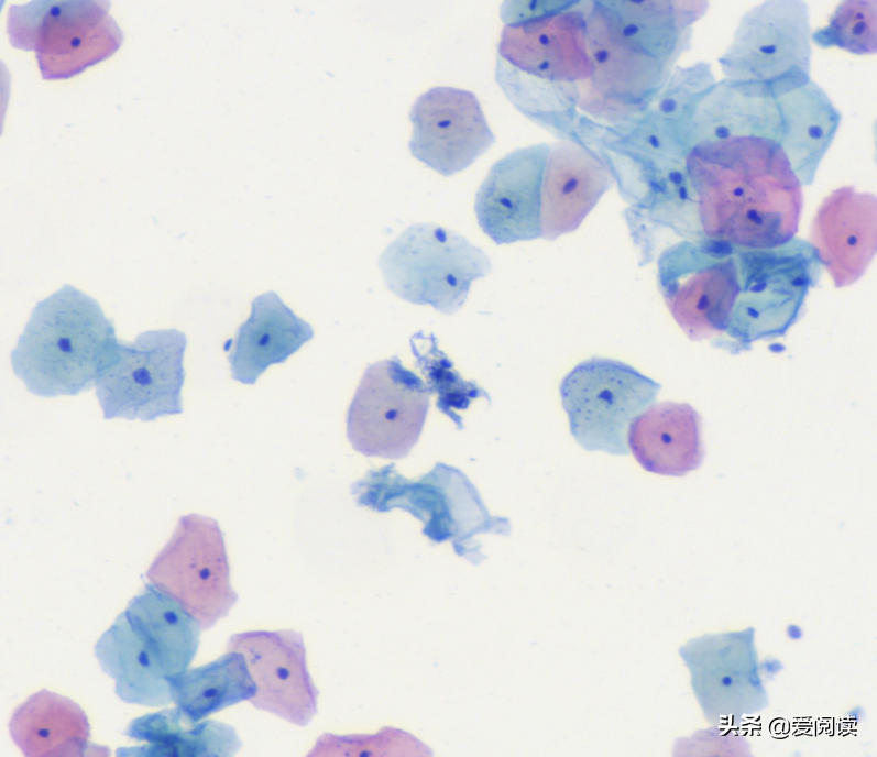 你试过吗？图像（细胞）分割