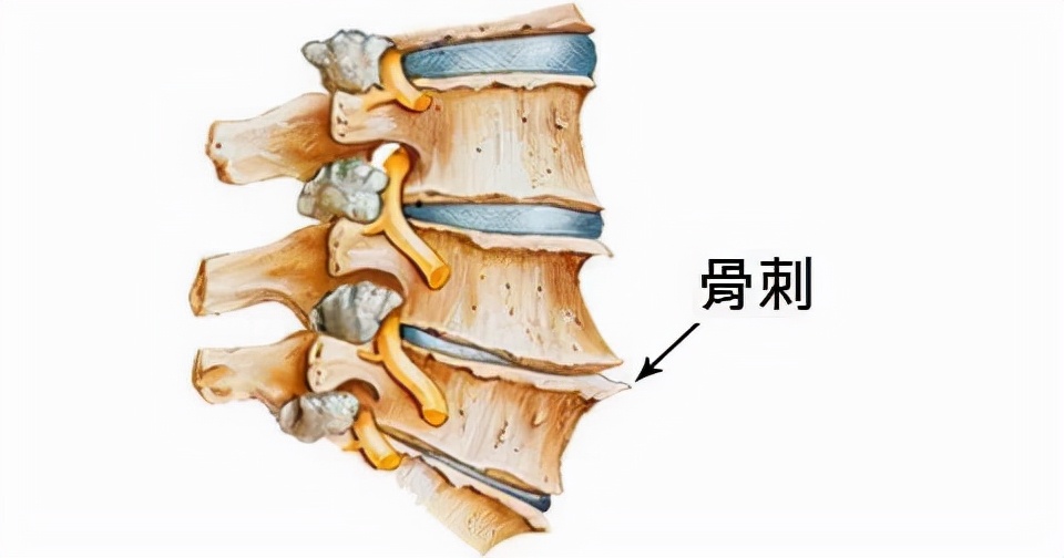 颈痛就吃止痛药？颈椎病千万别手术？有关颈椎病的十大误区请认清