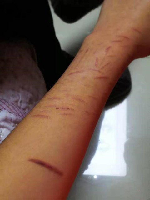 是在黑乎乎的房间里,拿着刀子,一刀一刀地在胳膊上留下令人心疼的刀痕