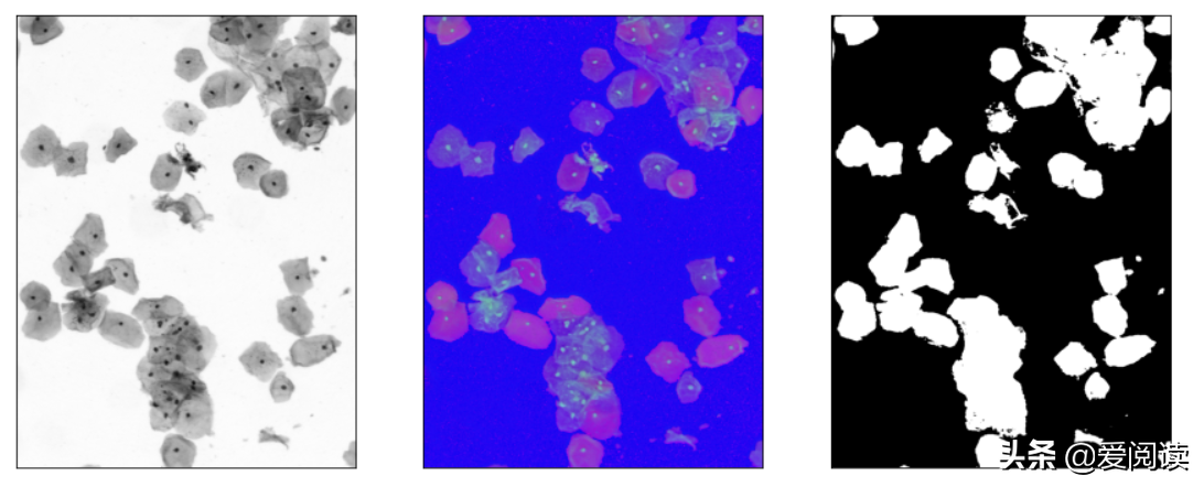 你试过吗？图像（细胞）分割