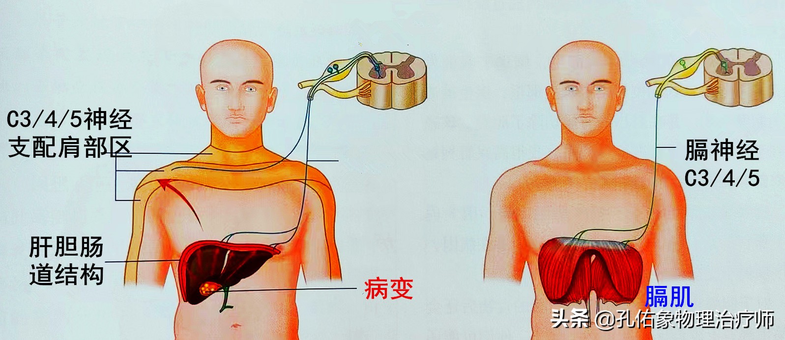 在我们的日常生活中,肩膀疼痛的人太多了,往往大家都会普遍认为是肩部