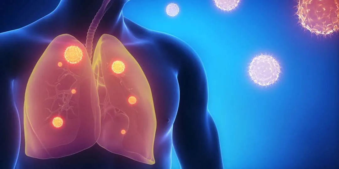 清肺——从呼吸负氧离子开始
