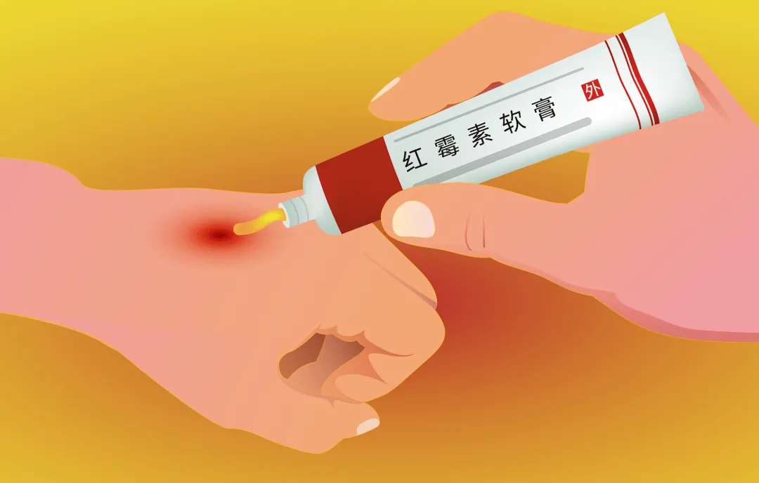红霉素软膏,在眼部涂两下,对身体影响有多大?了解下
