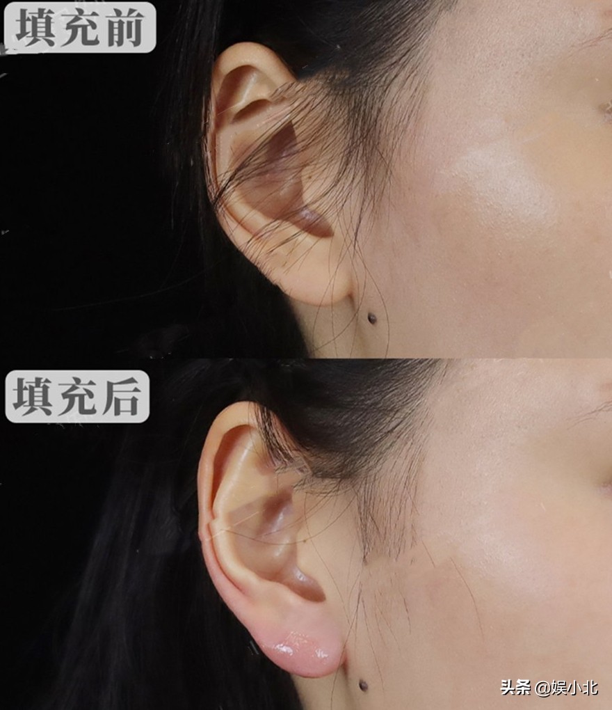 说刘亦菲牙齿丑的，是烤瓷牙看多了吧？